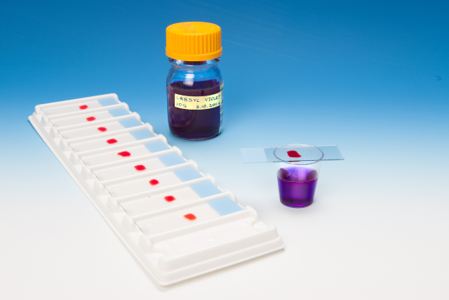 Histopathology Test