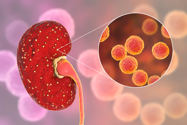 Nephrology Test